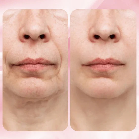 Zayle™ | Medicube - Mascarilla de Colágeno